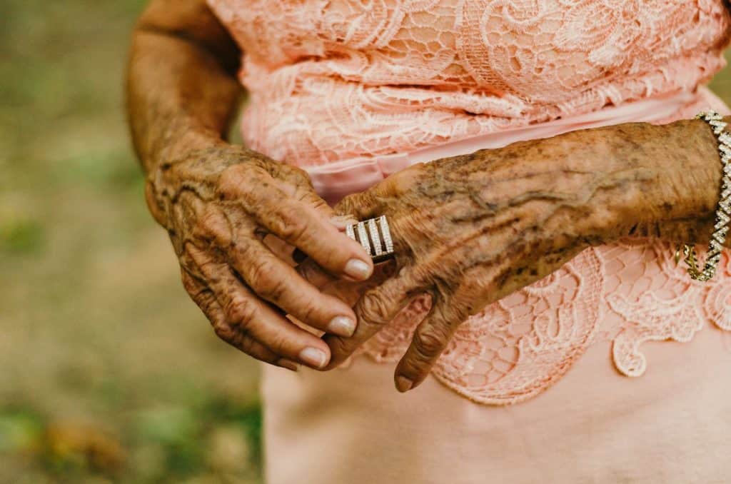 Do Your Veins Show More When You Are Dehydrated